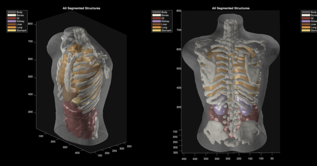 Something’s off with Midjourney’s pivot to body scanners
