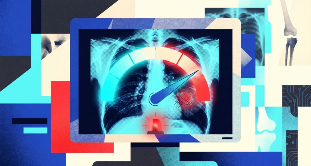 AI chatbots reading X-rays can be dangerously confident even when they’re wrong