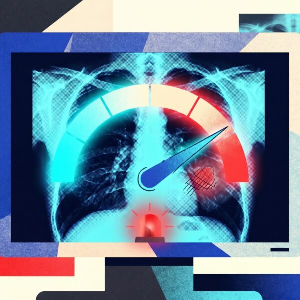 AI chatbots reading X-rays&hellip;