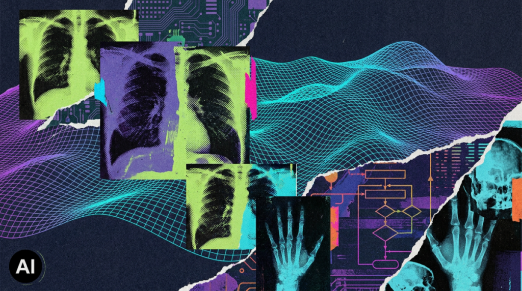 AI tools for breast cancer detection fall short of radiologists’ expectations