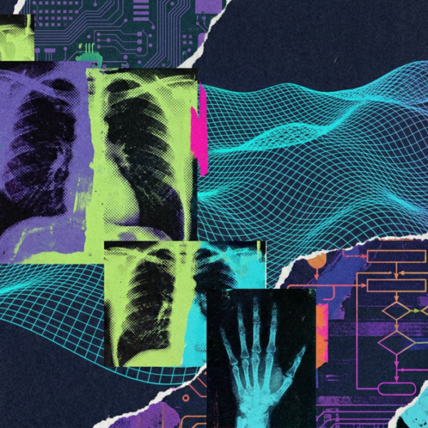 AI tools for breast&hellip;