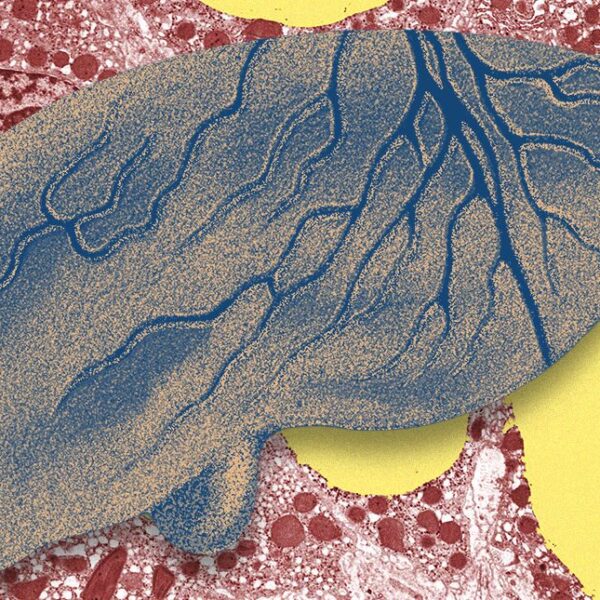 There’s a Fatty Liver&hellip;
