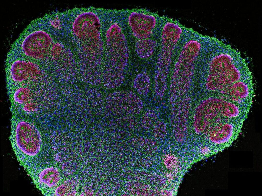 Computers Made of Human Brain Tissue Identify Braille Letters In Breakthrough